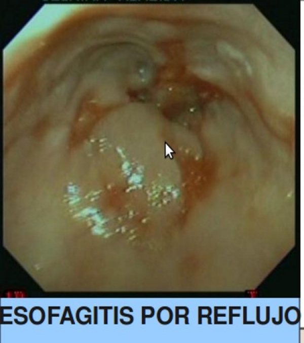 Paúl Esteban Coello Granda