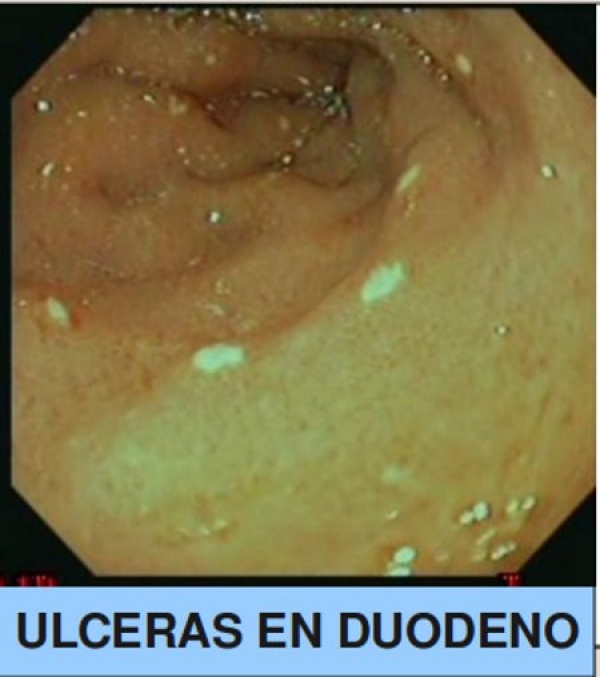 Paúl Esteban Coello Granda