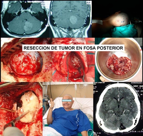 Carlos Fernando Arias Pesantez