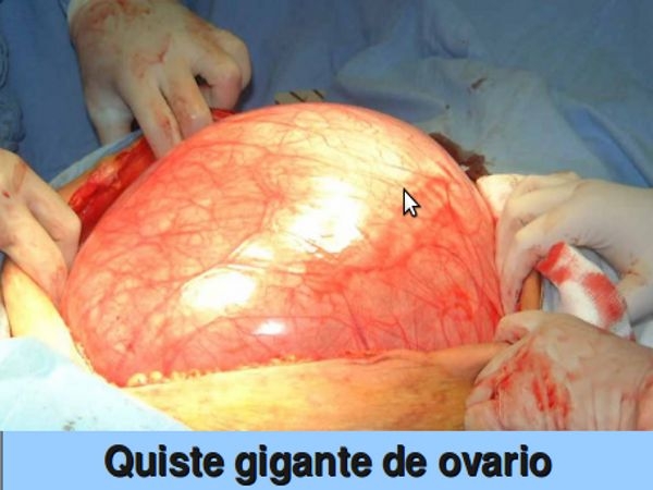 Jaime Patricio Ulloa Maurat