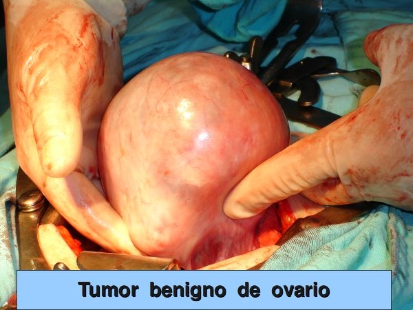 Jaime Patricio Ulloa Maurat