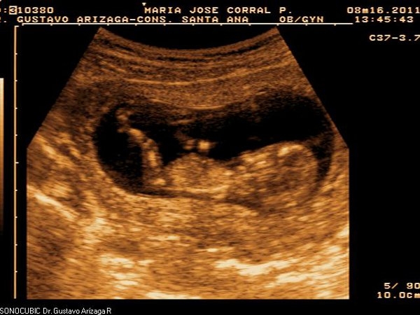 Gustavo Adolfo Arizaga Rovalino