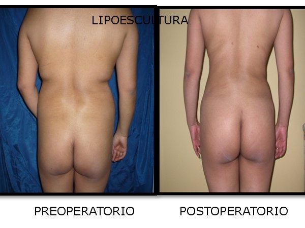 Víctor Antonio Salcedo Orellana