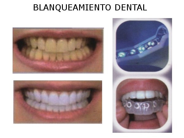 Santiago Daniel Serrano Piedra