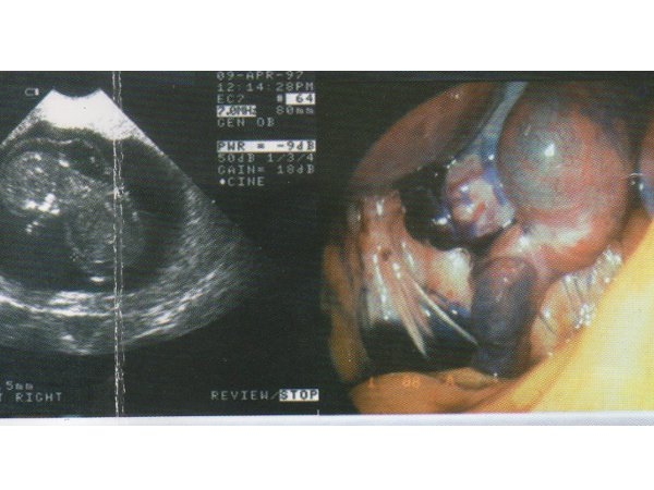 Miriam Cecilia Alban Bermeo
