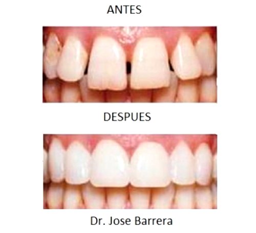 José Luis Barrera Pinos