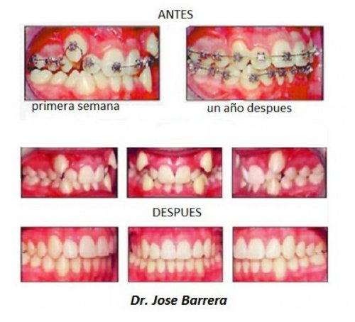 José Luis Barrera Pinos