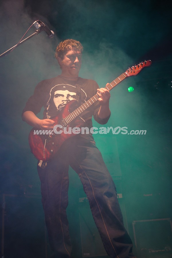 Sobrepeso