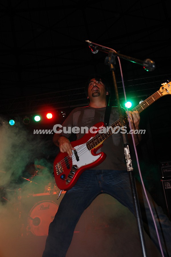 Sobrepeso