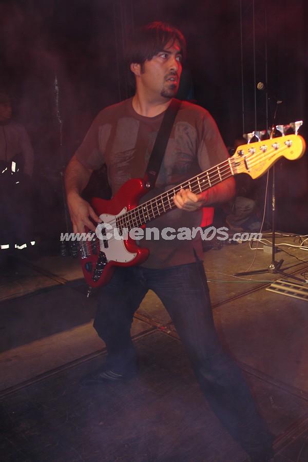 Sobrepeso