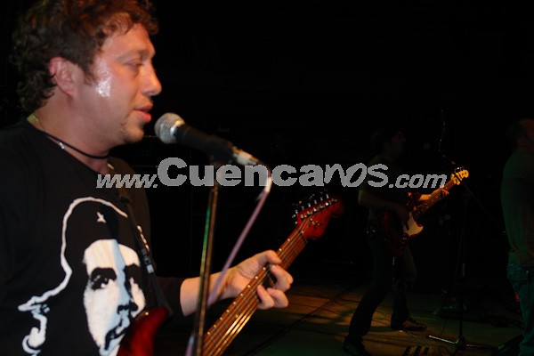 Sobrepeso