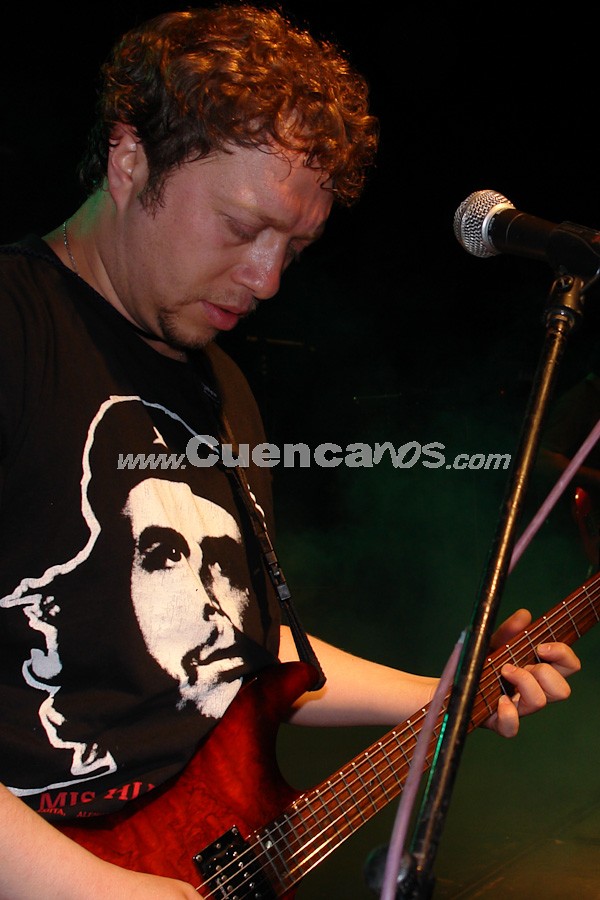 Sobrepeso